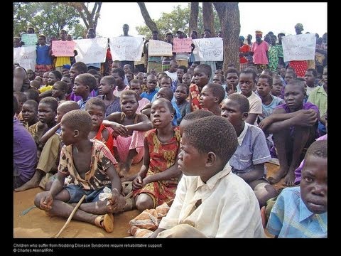 Uganda's nodding syndrome