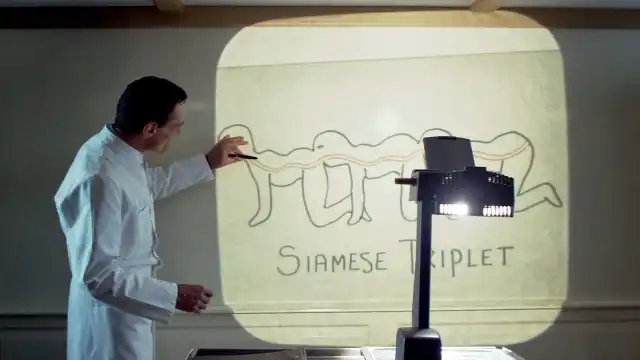 Is The Human Centipede Medically Possible? Real Science Human Centipede Medical