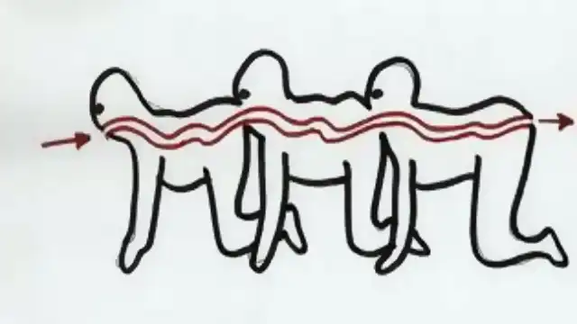 Is The Human Centipede Medically Possible? Real Science Human Centipede Plot