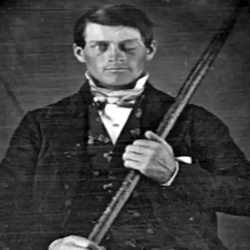 Phineas Gage: The True Story of History's Famous Brain Injury Phineas Gage