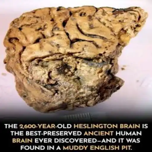 2,600-year-old Heslington brain