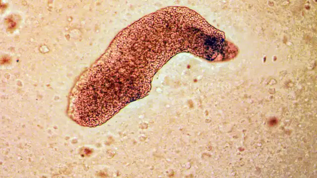 Syphilis Origins Mystery